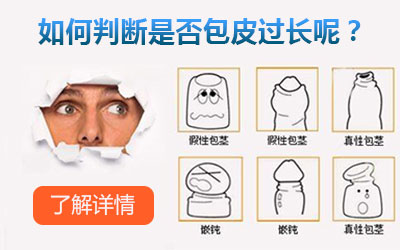 这是不是包皮过长